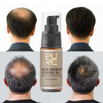 Fast Hair Growth Spray for Men - Inspiredluxe