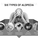 Fast Hair Growth Spray for Men - Inspiredluxe