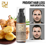 Fast Hair Growth Spray for Men - Inspiredluxe
