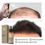 Fast Hair Growth Spray for Men - Inspiredluxe
