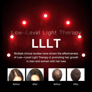 Laser Hair Regrowth System - Inspiredluxe